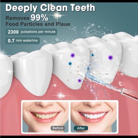 NIMMU Water Flosser for Teeth Picks, Mini Cordless Portable Water Dental
Flosser - Picture 6 of 10